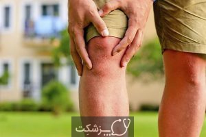 شایع ترین علل ضعف پا | پزشکت