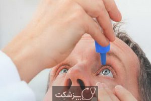 شایع ترین علت های درد چشم | پزشکت