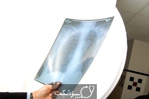 اسکن توموگرافی انتشار پوزیترون | پزشکت