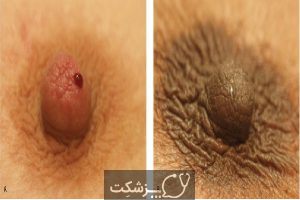 ساختار و عملکرد پستان |پزشکت