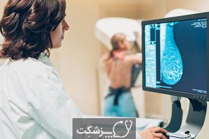 پستان فیبروکیستیک | پزشکت