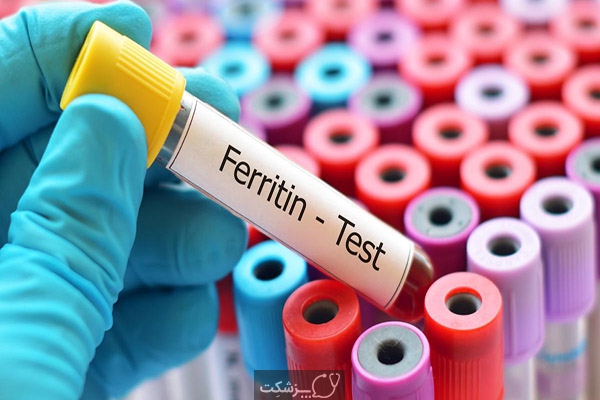 آزمایش خون فریتین | پزشکت