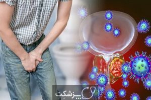 التهاب غده پروستات | پزشکت