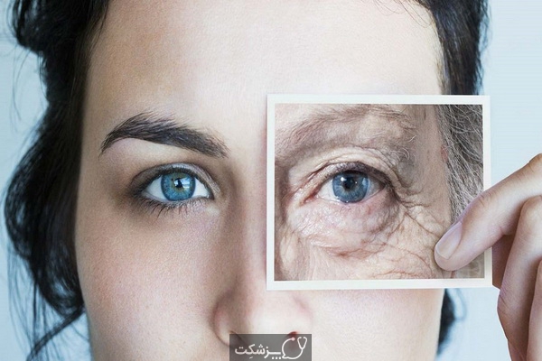 علائم پیری زودرس پوست | پزشکت