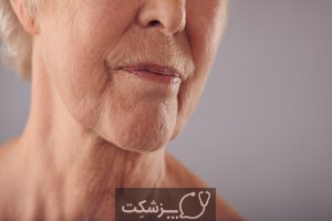 علائم پیری زودرس پوست | پزشکت