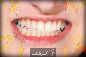 شایع ترین اختلالات دندانپزشکی | پزشکت