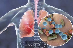 شایعترین علل بیماری های تنفسی | پزشکت