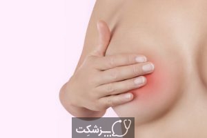 بیماری نوک پستان | پزشکت