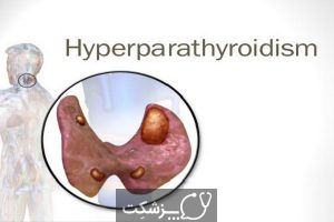 هایپرپاراتیروئیدیسم | پزشکت