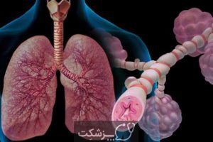 شایع ترین بیماری های تنفسی | پزشکت
