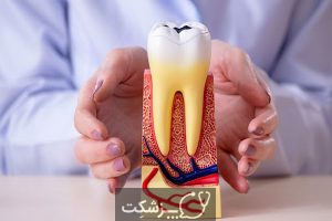 شایع ترین اختلالات دندانپزشکی | پزشکت