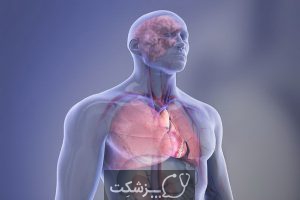 پانزده بیماری سیستم گردش خون | پزشکت