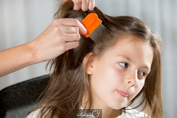 ریزش مو در کودکان | پزشکت