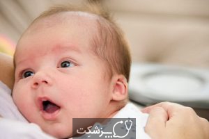 ترک خوردن لب های نوزاد | پزشکت