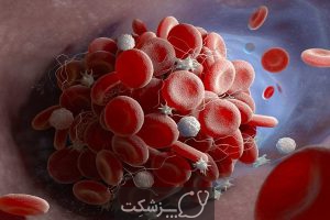 شایع ترین علائم لخته شدن خون | پزشکت