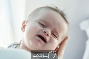 ترک خوردن لب های نوزاد | پزشکت