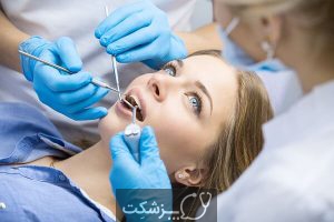 لکه های سفید روی دندان | پزشکت