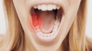 درد دندان را چگونه در خانه درمان کنیم؟ | پزشکت