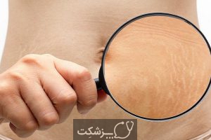 علت ترک خوردگی پوستی من چیست؟ | پزشکت