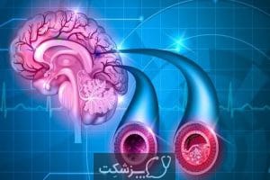 علائم آسیب به ناحیه راست و چپ مغز چیست؟ | پزشکت