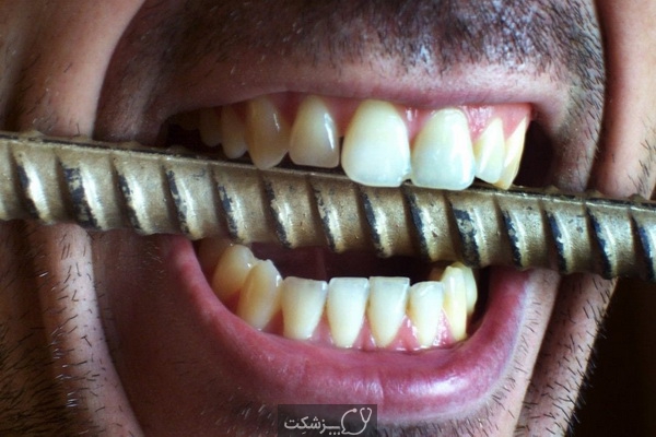 علت حس طعم فلز در دهان چیست؟ | پزشکت