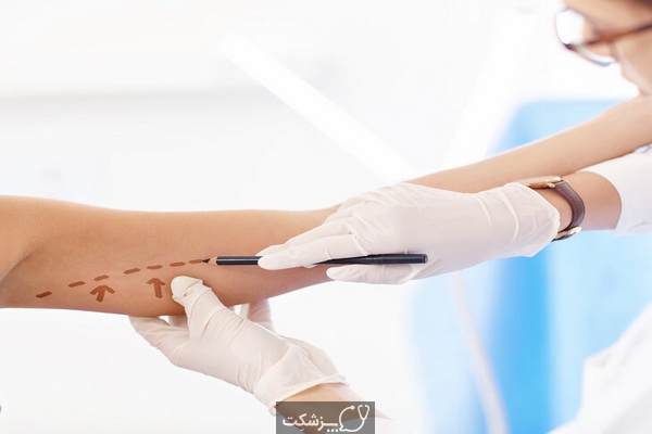 جراحی لیفت بازو چه خطراتی دارد؟ | پزشکت