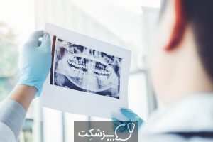 علت دندان قروچه در کرونا | پزشکت