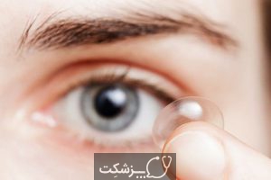 شایعترین علل خارش چشم چیست؟ | پزشکت