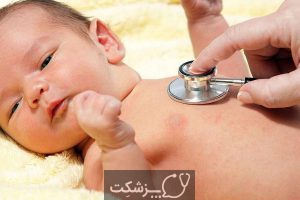 رفلکس اکستروژن در نوزادان چیست؟ | پزشکت