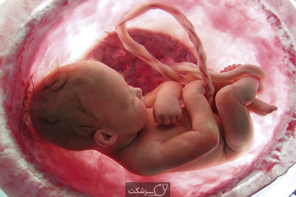 چگونه از سقط جنین پیشگیری کنیم؟ | پزشکت