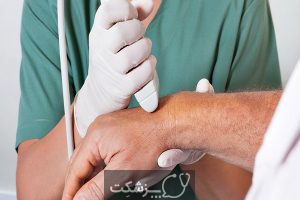 پیچ خوردگی مچ دست، از علائم تا درمان | پزشکت