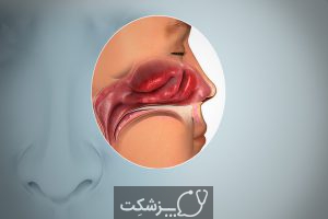 از دست دادن طعم و بو از علائم کرونا | پزشکت