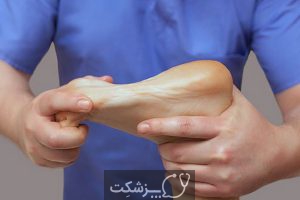 درمان سوزش کف پا | پزشکت