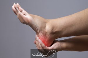 درمان سوزش کف پا | پزشکت