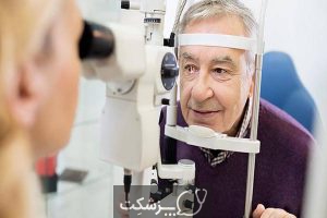 انواع سرطان های چشم | پزشکت