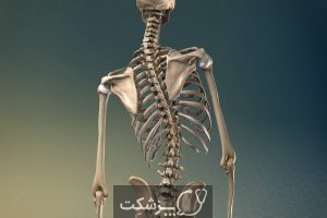 دکسترواسکولیوز | پزشکت