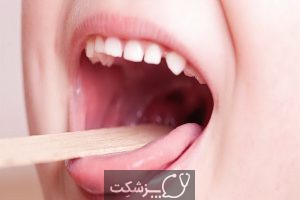 خارش گلو | پزشکت