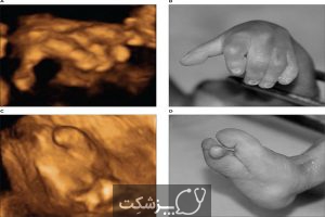 انتظارات سونوگرافی سطح 2 در بارداری | پزشکت