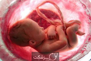 انتظارات سونوگرافی سطح 2 در بارداری | پزشکت