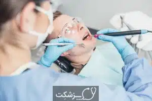 عقب رفتن لثه ها | پزشکت