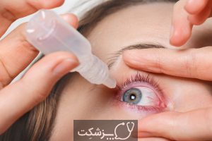 درمان های خانگی برای چشم درد | پزشکت