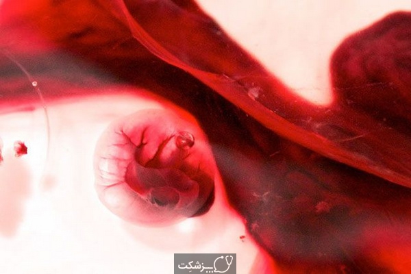 قاعدگی بعد از سقط جنین | پزشکت
