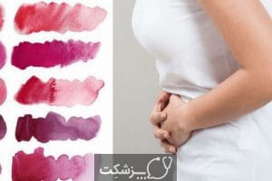 رنگ خون قاعدگی