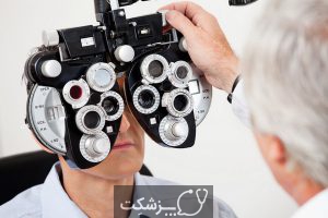 تست بینایی چیست؟ | پزشکت
