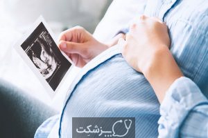 انتظارات سونوگرافی سطح 2 در بارداری | پزشکت