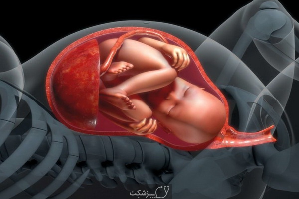 عوارض بارداری | پزشکت