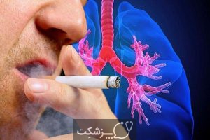 رژیم غذایی برای سرطان ریه | پزشکت