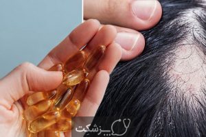 آیا امگا 3 برای رشد مو مفید است؟ | پزشکت