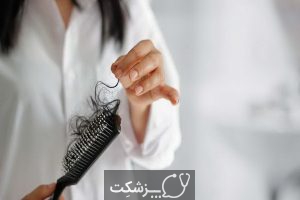 ریزش مو در بیماران کرونایی | پزشکت