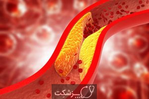 چگونه تشخیص دهیم که لخته خون داریم؟ | پزشکت